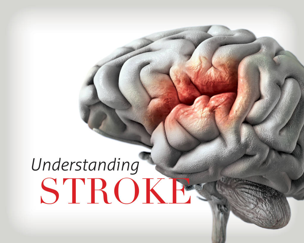 Strong Connection between Insomnia and Stroke