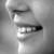 Teeth Whitening Sensitivity Causes and How to Avoid It