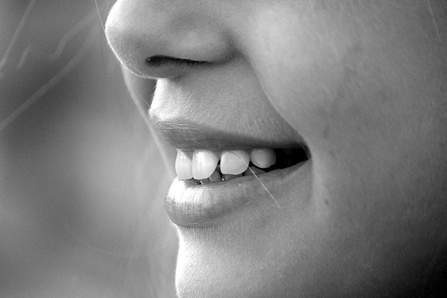 Teeth Whitening Sensitivity Causes and How to Avoid It