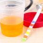 Understanding Your Bladder Health: The Importance of the Bladder Void Test