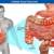 Natural Remedies For Irritable Bowel Syndrome