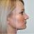 Ways to Feel Good About Your Nose