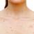 How To Get Rid Of Chest Acne