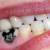 15 Amazing Facts About Your Teeth
