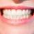 Benefits of Professional Teeth Whitening