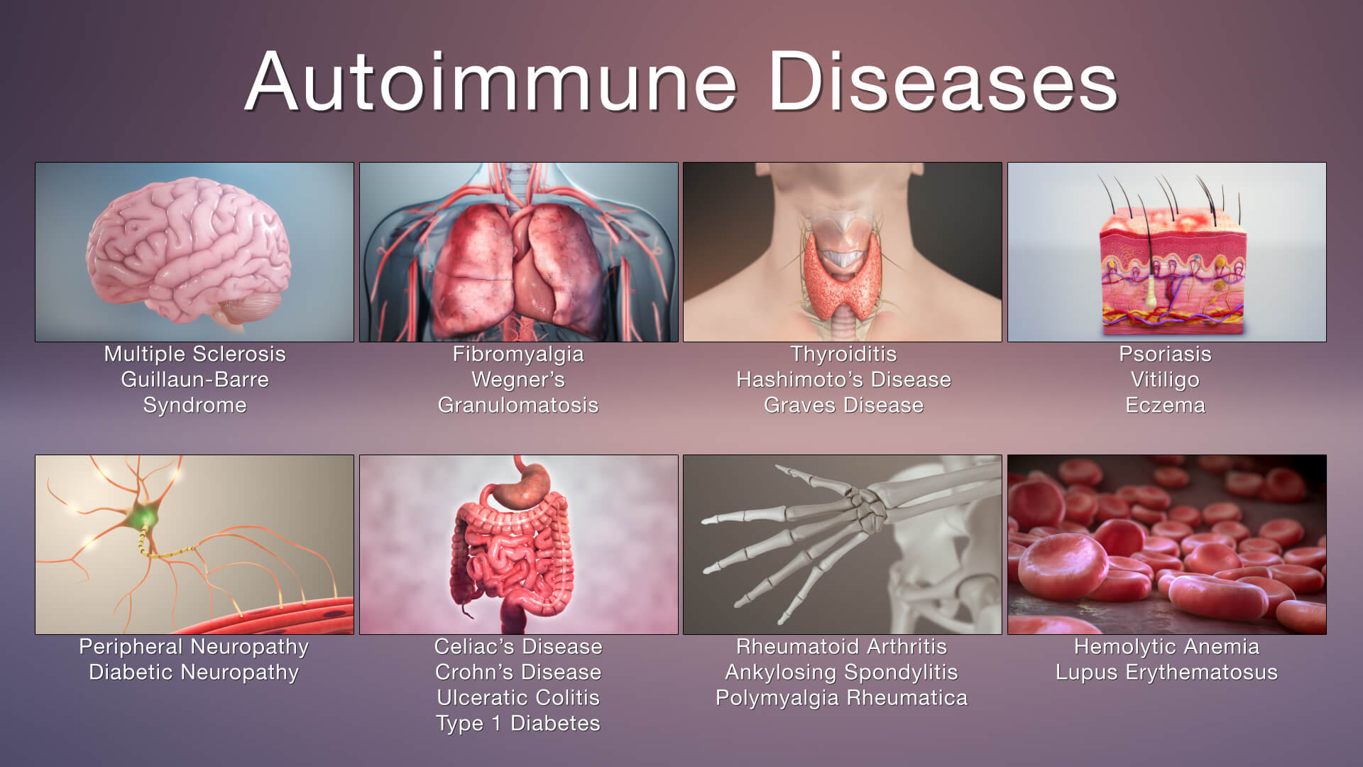 Types Of Autoimmune Diseases