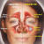 What is sinus congestion?