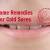 Home Remedies for Cold Sores