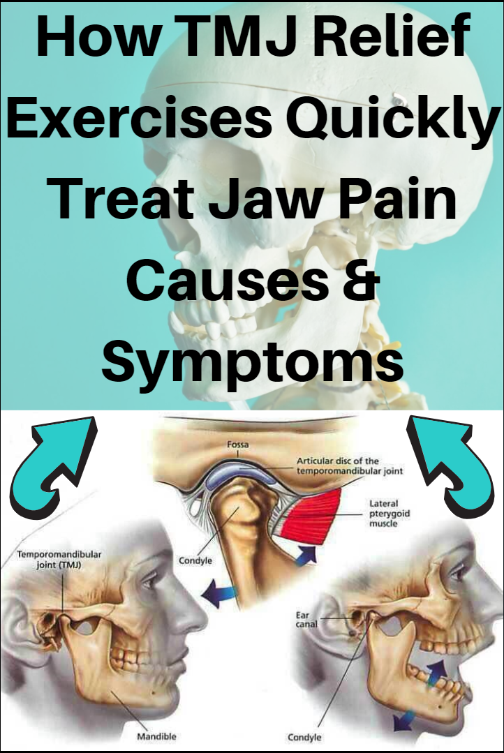 tmj relief exercises - tmj - tmj exercises - jaw pain causes - jaw pain relief - tmj symptoms - tmj massage - tmj relief - tmj exercises jaw pain - tmj physical exercises therapy - tmj exercises trigger points - jaw pain