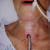 Laryngectomy Post Op Care