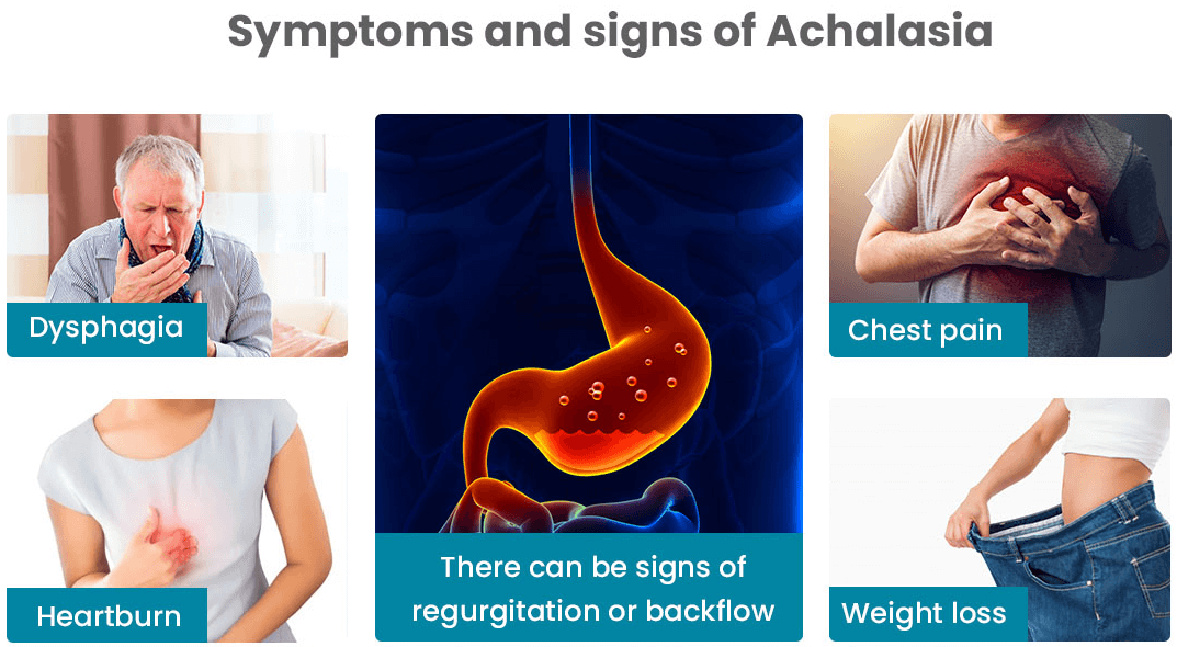 Symptoms Of Achalasia