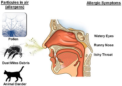 What is sinus congestion?