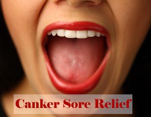 canker sore home remedies