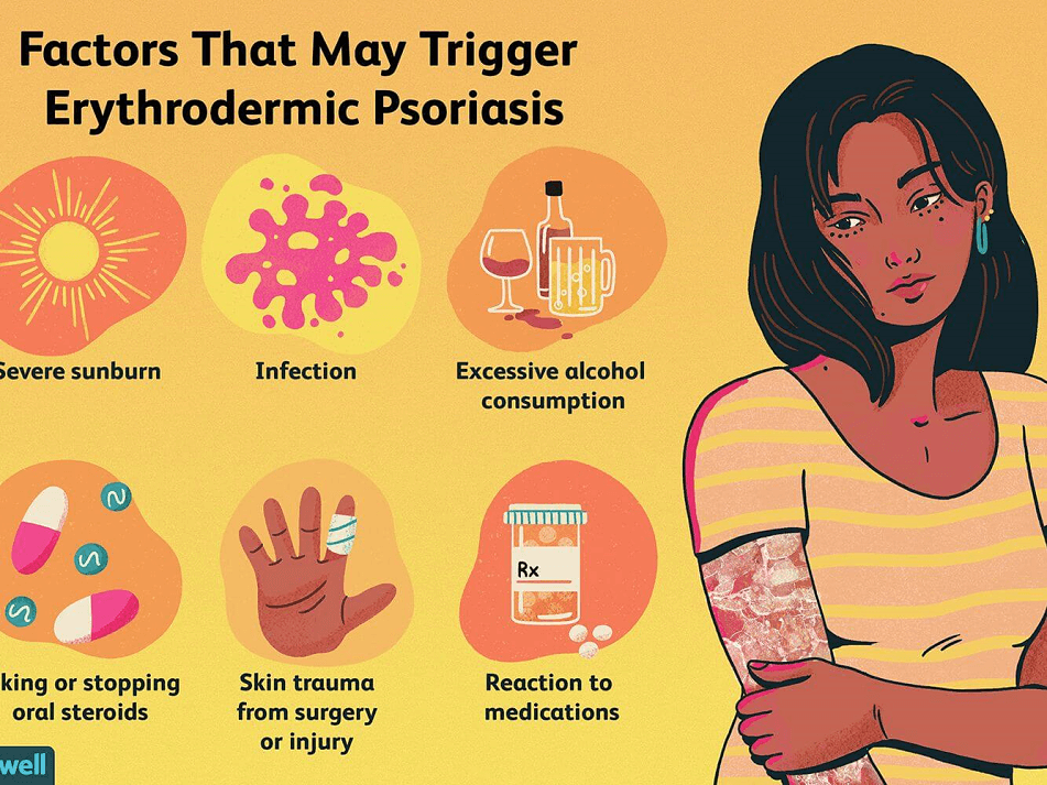 erythrodermic psoriasis triggers