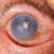 Eye Pain: Causes Symptoms and Treatment