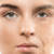 FAQ on Vampire Facelift