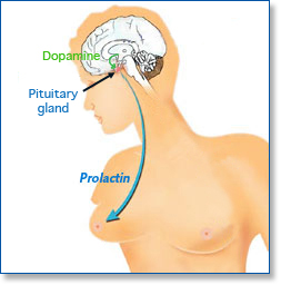 hyperprolactemia