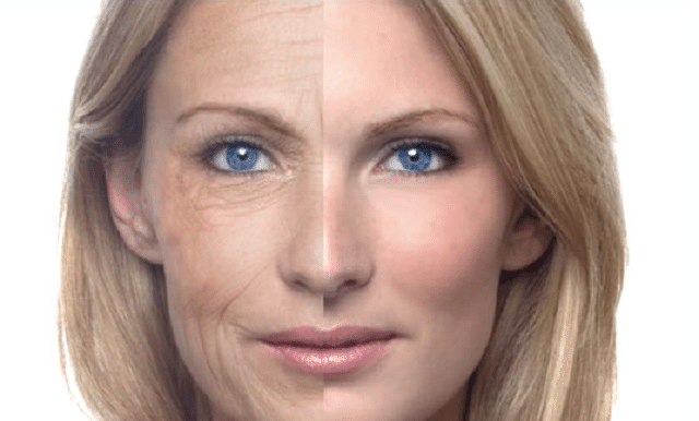 Best Face Wrinkle Treatment