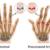 Rheumatoid Arthritis