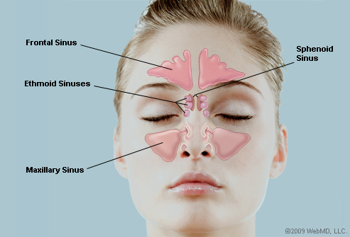 What is sinus congestion?