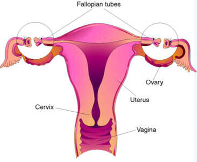 tubal ligation