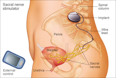 overactive bladder medications